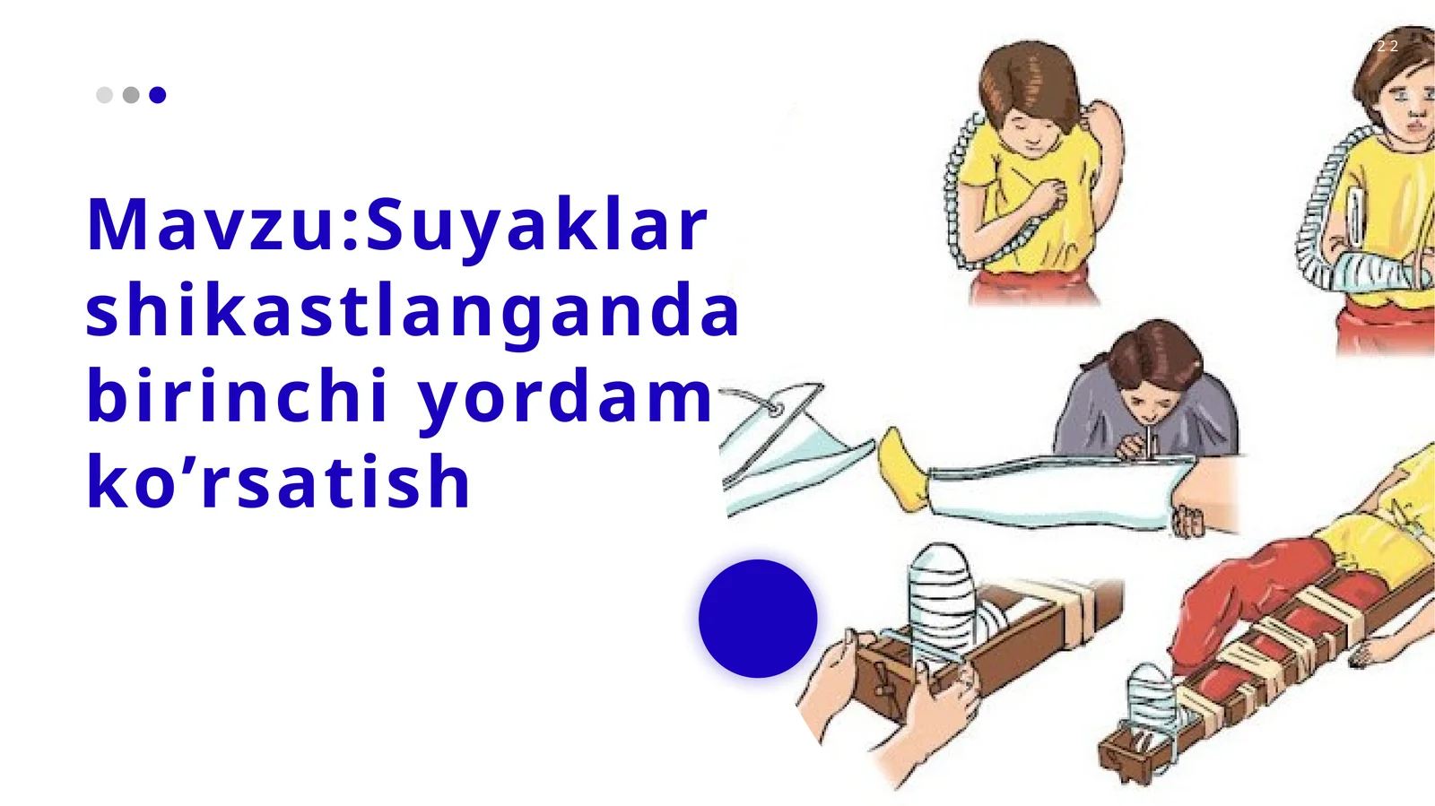 Suyaklar shikastlangan dabirinchi yordam ko’rsatish